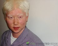 Albino asian.jpg